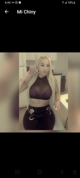 Bebesita complaciente ,,, divertida ,, comunicativa ,,, y todo lo lindo que se te pueda ocurrir ,,, 😋😋🥰🥰 no dudes en llamarme te aseguro que seré lo mejor que pasará en tu vida 